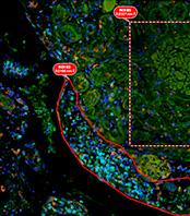 Live cell imaging