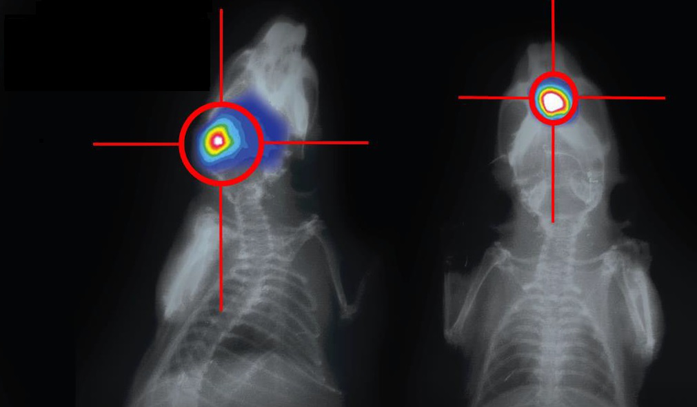 OptiMAX IGRT – Precision X-Ray